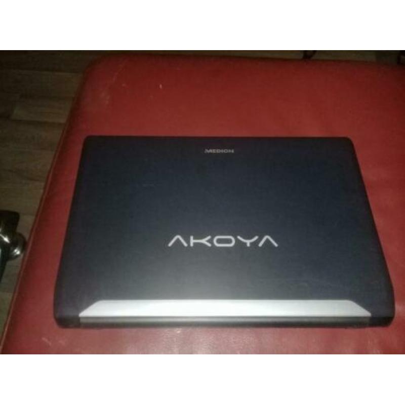 Defecte Medion Akoya